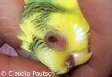 Schwere Sinusitis