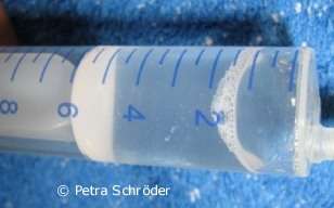 Aus dem Bauch entferntes Wasser