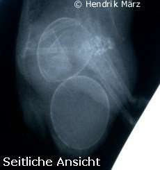 Seitliches Röntgenbild einer Legenot