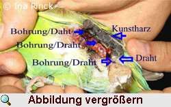 Erläuterung des Fixateurs an Lennys Bein