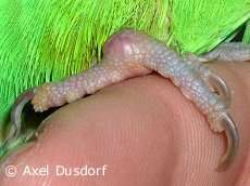 Zerrung im Bein