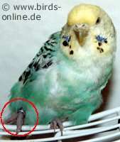 Schonhaltung bei Fußzerrung