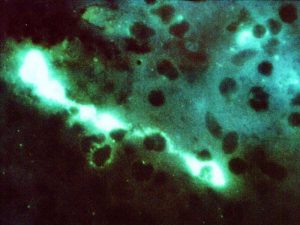 Blick auf den Erreger der Psittakose: Chlamydophila psittaci (Färbung durch direkte Immunfluoreszenz mit fluoreszierenden Antikörpern (FA)). © CDC/Dr. Vester Lewis