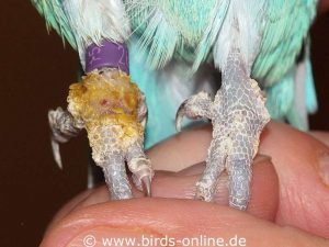 This budgie is affected by Knemidocoptes mutans as the crusts and dermatitis on his right foot indicate.