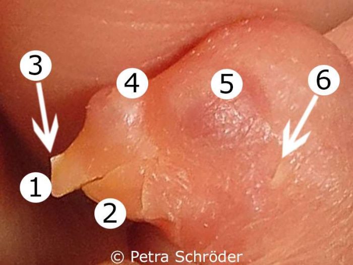 Kopf eines frisch geschlüpften Wellensittichs: (1) Oberschnabel, (2) Unterschnabel, (3) Eizahn, (4) Nase, (5) noch geschlossenes Auge, (6) Ohröffnung